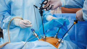Comparison of Laparoscopic and Open Surgery_ Benefits and Recovery
