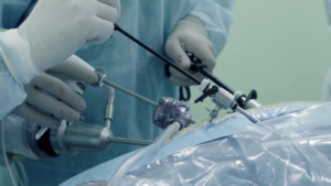 Gynaecological Surgery via Laparoscopy_ What Conditions Does It Treat and When Is It Indicated